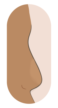Profile drawing of a flat nose: low projection with a broad bridge