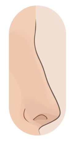 Profile drawing of a Greek nose: one straight line from brow to tip